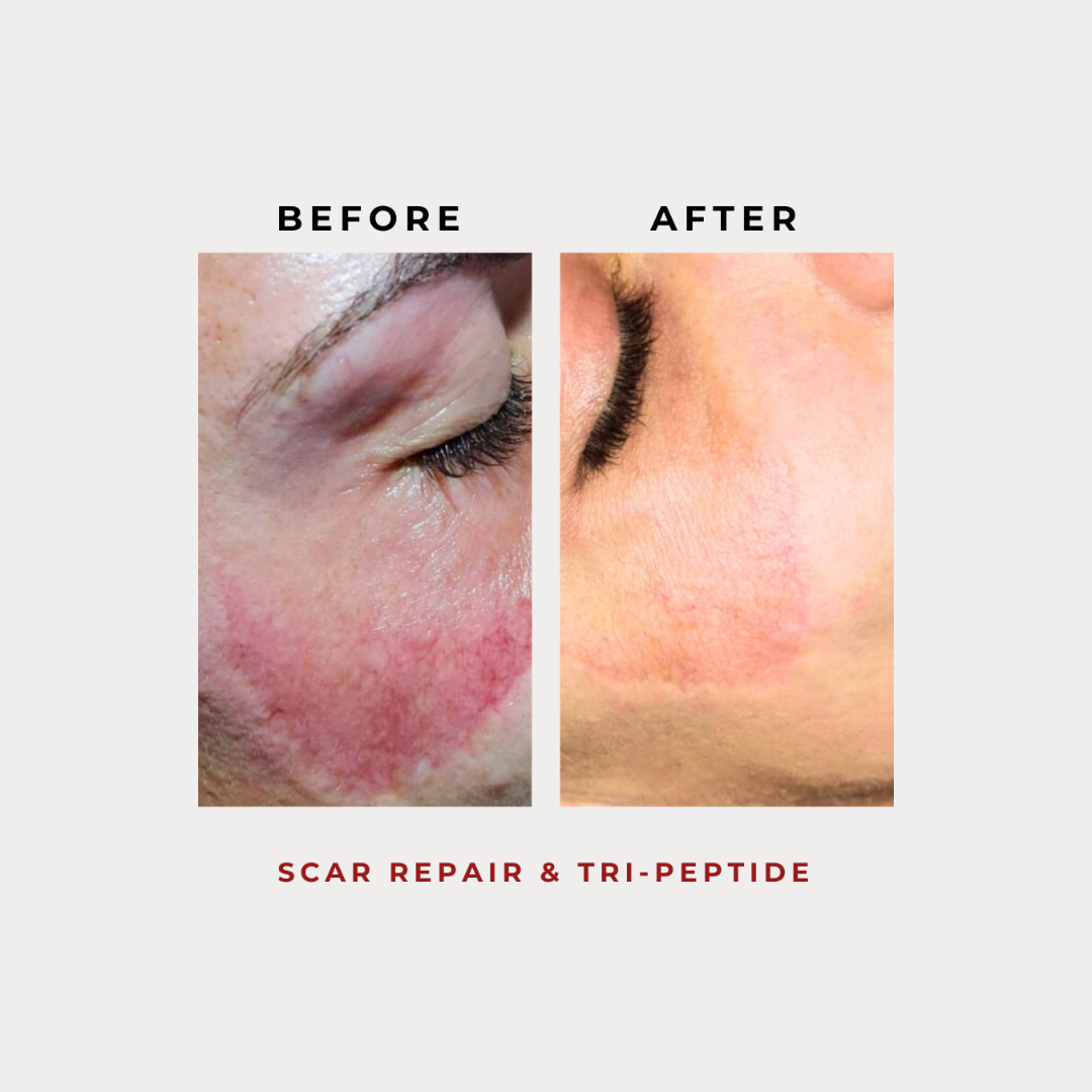 Scar Repair & Tri-Peptide 30g